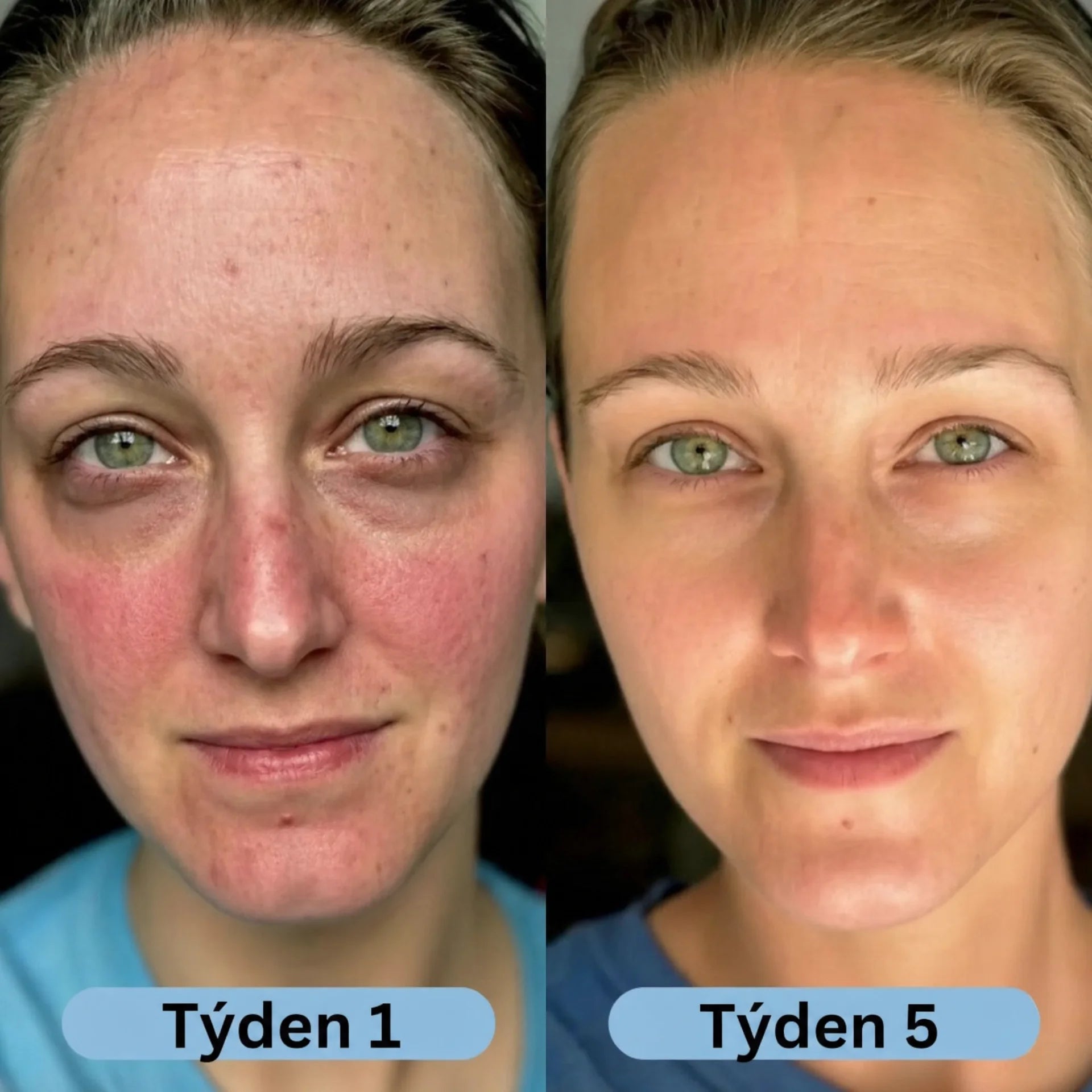 Korejské kolagenové sérum pro zralou pleť