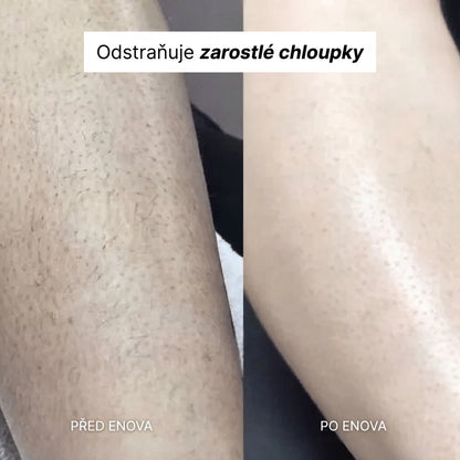 Enova Holicí strojek 5 v 1