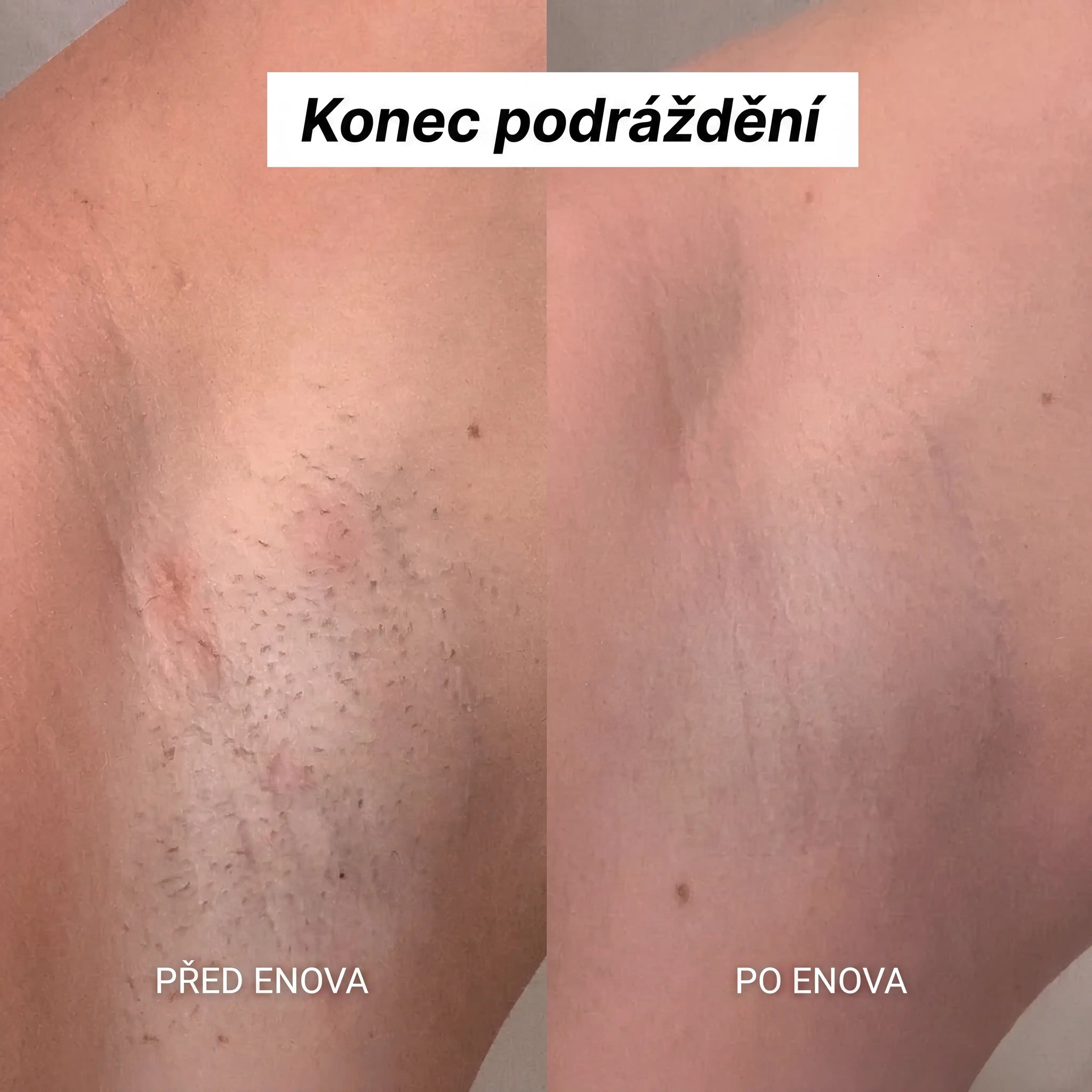 Enova Holicí strojek 5 v 1