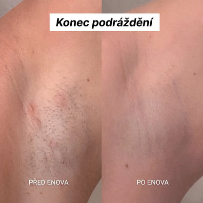 Enova Holicí strojek 5 v 1