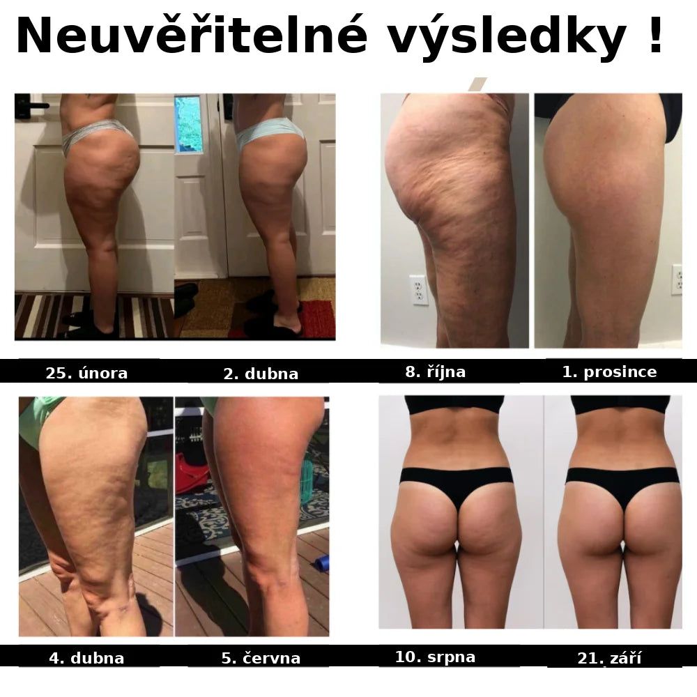 Enova 3D Anticelulitidové legíny