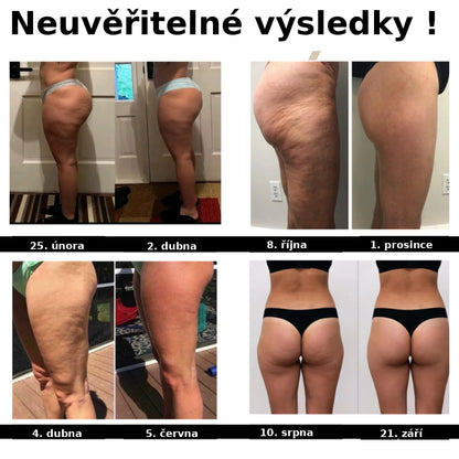 Enova 3D Anticelulitidové legíny